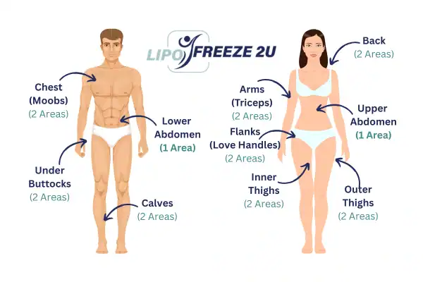 Areas you can have fat freezing treatment Christchurch